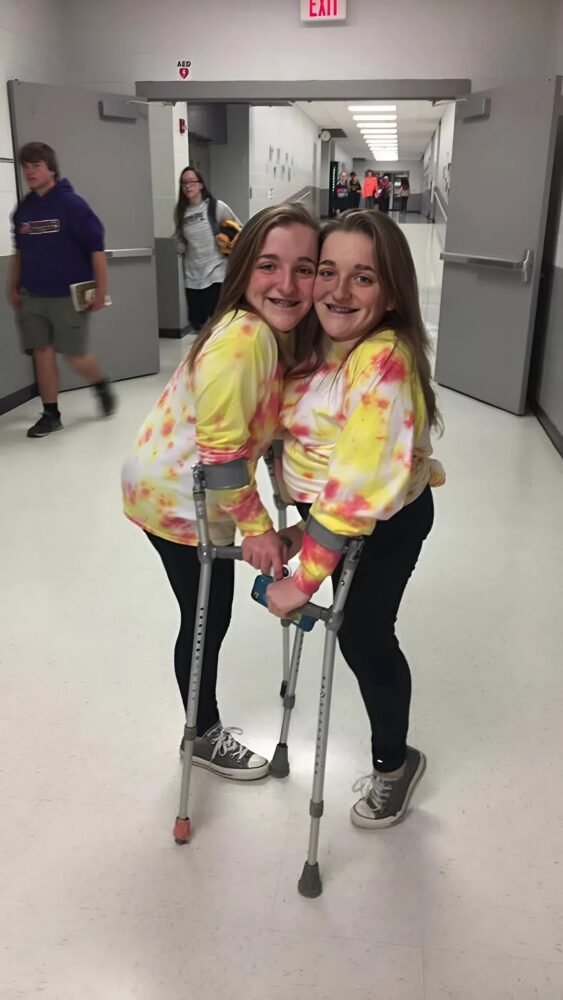 The garrison twins: an inspiring journey of courage and love