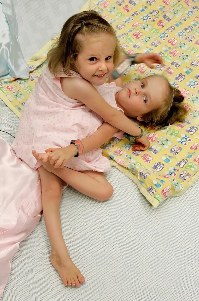 Conjoined twins separated at the age of four, now thriving at 17 with one leg each, "feel like everyone else"