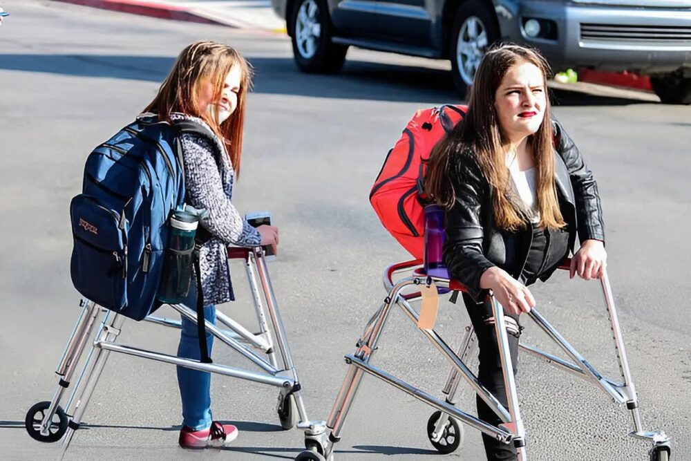 Conjoined twins separated at the age of four, now thriving at 17 with one leg each, "feel like everyone else"