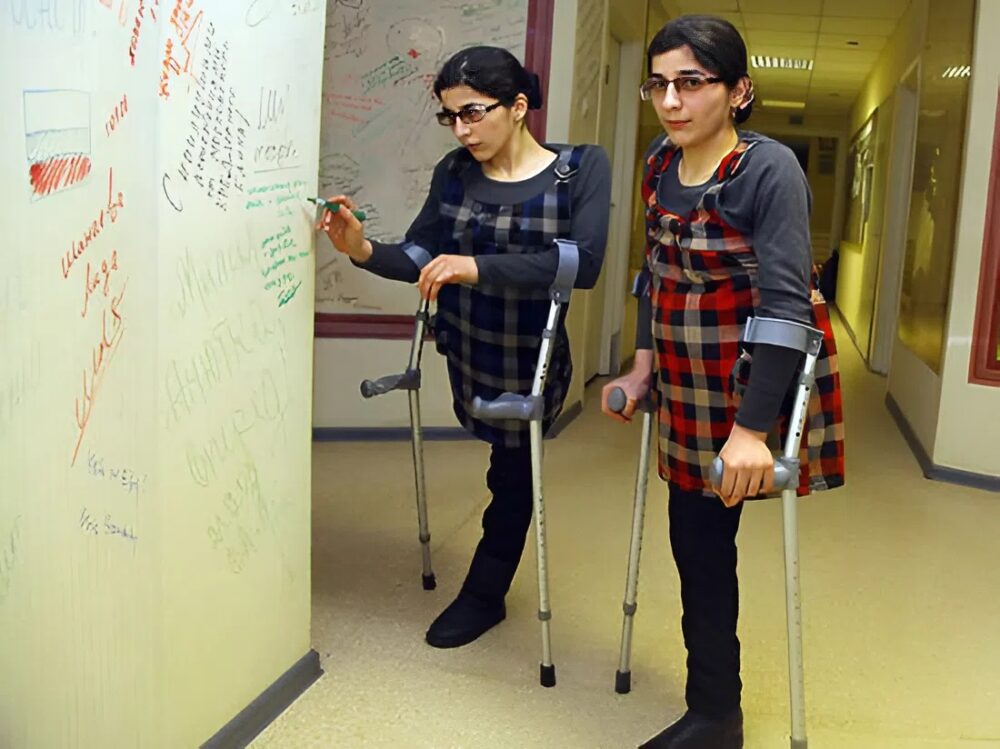 Zita and Gita Rezakhany: Their incredible journey after a risky separation at the age of 11, defying the impossible