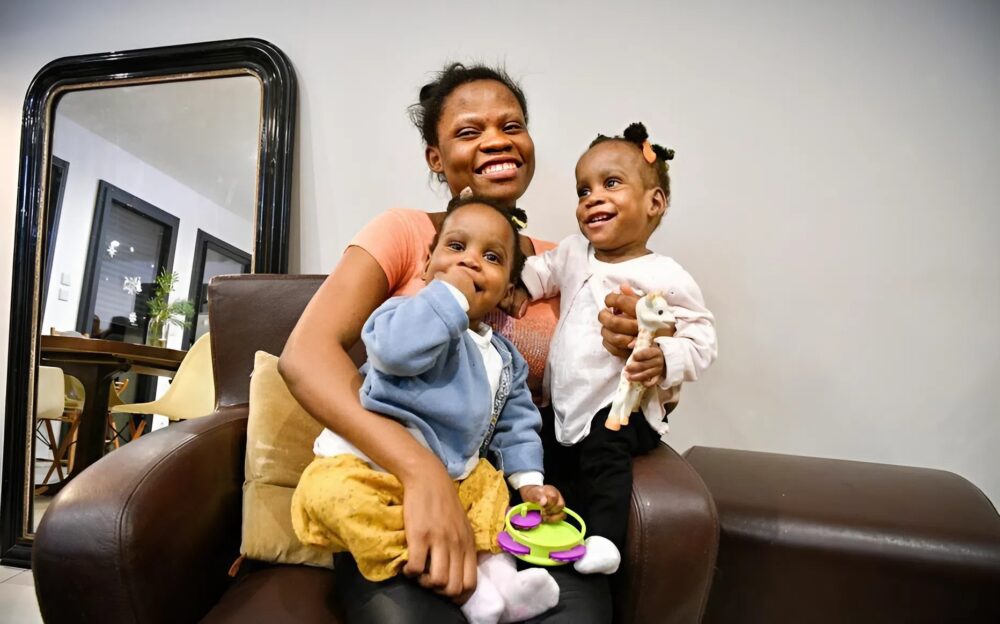 From fear to hope: the incredible journey of siamese twins bissie and eyenga, a fight for life