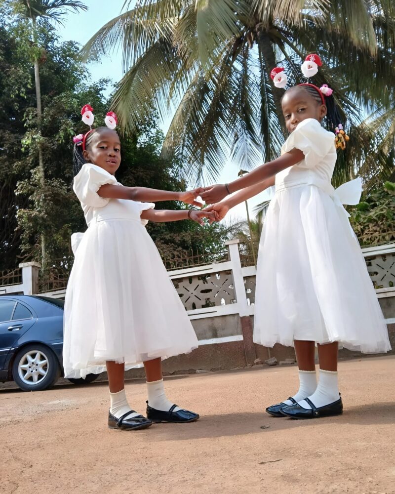 From fear to hope: the incredible journey of siamese twins bissie and eyenga, a fight for life